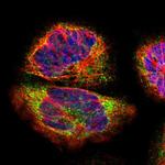 NSDHL Antibody in Immunocytochemistry (ICC/IF)