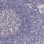 NSDHL Antibody in Immunohistochemistry (IHC)