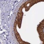 NSDHL Antibody in Immunohistochemistry (IHC)