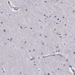 NAGA Antibody in Immunohistochemistry (IHC)