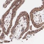 VASH1 Antibody in Immunohistochemistry (IHC)