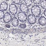 TECPR2 Antibody in Immunohistochemistry (IHC)