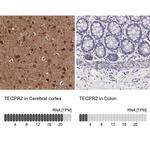 TECPR2 Antibody