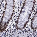 SF3A1 Antibody in Immunohistochemistry (IHC)