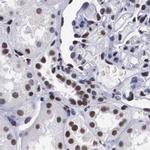 SF3A1 Antibody in Immunohistochemistry (IHC)