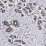 SF3A1 Antibody in Immunohistochemistry (IHC)