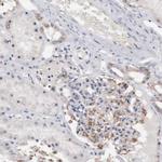 INF2 Antibody in Immunohistochemistry (IHC)