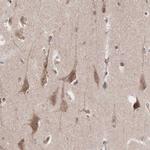 INF2 Antibody in Immunohistochemistry (IHC)