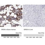 Serglycin Antibody in Immunohistochemistry (IHC)