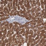 ACOT4 Antibody in Immunohistochemistry (IHC)