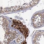 NPC2 Antibody in Immunohistochemistry (IHC)