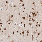 FKBP25 Antibody in Immunohistochemistry (IHC)