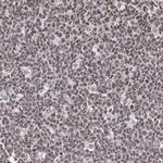 NKAP Antibody in Immunohistochemistry (IHC)