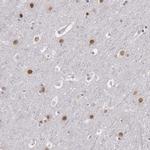 NKAP Antibody in Immunohistochemistry (IHC)