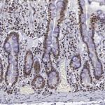 NKAP Antibody in Immunohistochemistry (IHC)