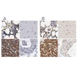 PYGL Antibody in Immunohistochemistry (IHC)