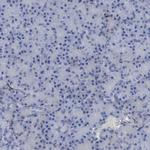 PYGL Antibody in Immunohistochemistry (IHC)