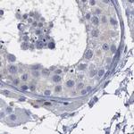 PYGL Antibody in Immunohistochemistry (IHC)