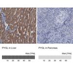 PYGL Antibody