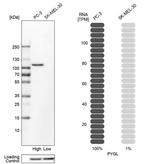 PYGL Antibody