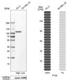 PYGL Antibody in Western Blot (WB)