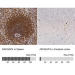 RhoGAP4 Antibody in Immunohistochemistry (IHC)