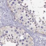 RhoGAP4 Antibody in Immunohistochemistry (IHC)