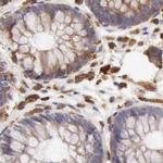 RhoGAP4 Antibody in Immunohistochemistry (IHC)