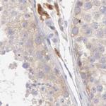 RhoGAP4 Antibody in Immunohistochemistry (IHC)