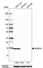 SNRPD3 Antibody in Western Blot (WB)