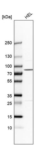 PLA2G6 Antibody in Western Blot (WB)