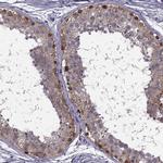 MAGEB1 Antibody in Immunohistochemistry (IHC)