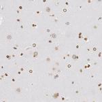 UNC84B Antibody in Immunohistochemistry (IHC)