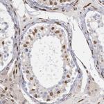 UNC84B Antibody in Immunohistochemistry (IHC)