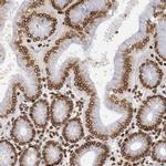 UNC84B Antibody in Immunohistochemistry (IHC)