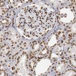 UNC84B Antibody in Immunohistochemistry (IHC)