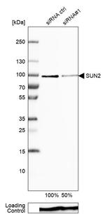 UNC84B Antibody in Western Blot (WB)