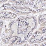 GAL3ST1 Antibody in Immunohistochemistry (IHC)