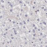 DGCR14 Antibody in Immunohistochemistry (IHC)