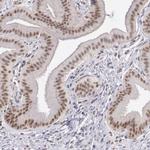 DGCR14 Antibody in Immunohistochemistry (IHC)