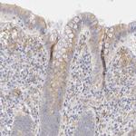 PLOD3 Antibody in Immunohistochemistry (IHC)