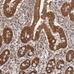 MPST Antibody in Immunohistochemistry (IHC)