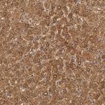 MPST Antibody in Immunohistochemistry (IHC)