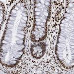 PC4 Antibody in Immunohistochemistry (IHC)