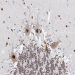 PC4 Antibody in Immunohistochemistry (IHC)