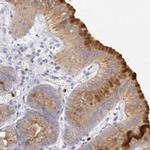 RAB27A Antibody in Immunohistochemistry (IHC)