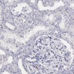 RAB27A Antibody in Immunohistochemistry (IHC)