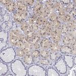 Adenosine Deaminase Antibody in Immunohistochemistry (IHC)