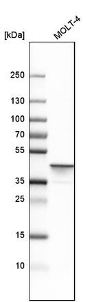 Adenosine Deaminase Antibody in Western Blot (WB)