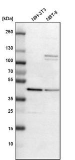 Adenosine Deaminase Antibody in Western Blot (WB)